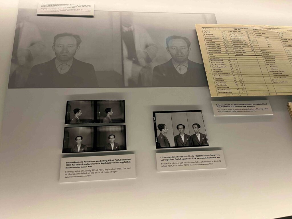 Racial Examination - Buchenwald Concentration Camp
